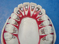 シミュレーション